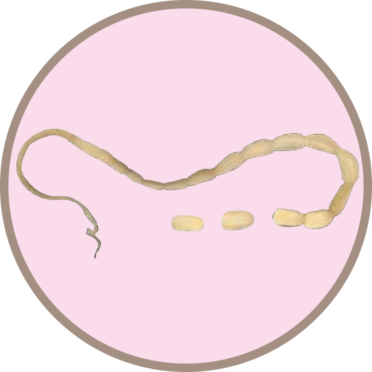 TAPEWORM